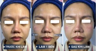 Công Nghệ Chăm Sóc Da Tại Dr Choice Clinic Có Hiện Đại Không? 2